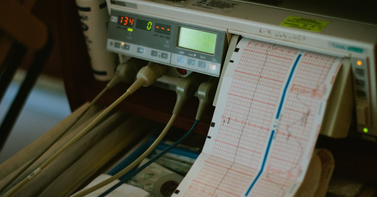 discover effective pulse align techniques to enhance precision in your projects. learn how to implement these methods for improved performance and accuracy in various applications.