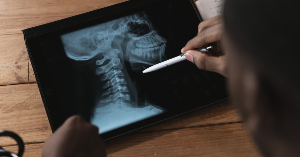 discover the causes and solutions for tech neck, a growing concern in our digital age. learn how to alleviate discomfort and improve posture with practical tips and exercises.