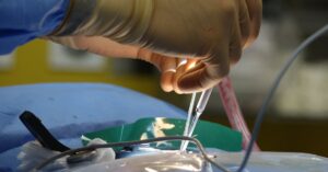 discover effective treatments, symptoms, and causes of spinal stenosis. learn how this condition affects your spine and explore options for relief and management.