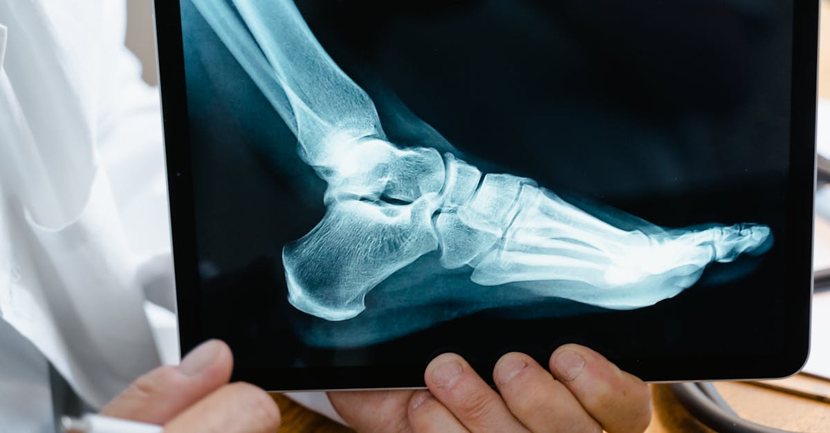 La technologie de décompression neurovertébrale de TAGMED est comparée à d'autres traitements couramment utilisés, comme les analgésiques, les injections de corticostéroïdes, les options chirurgicales ou la physiothérapie traditionnelle. Les avantages sont évidents. Contrairement à de nombreuses interventions invasives, la décompression neurovertébrale minimise les risques liés aux médicaments tout en offrant une guérison potentiellement plus rapide. Cette alternative fondée sur des données probantes en fait un choix incontournable pour ceux qui recherchent des options plus sûres.