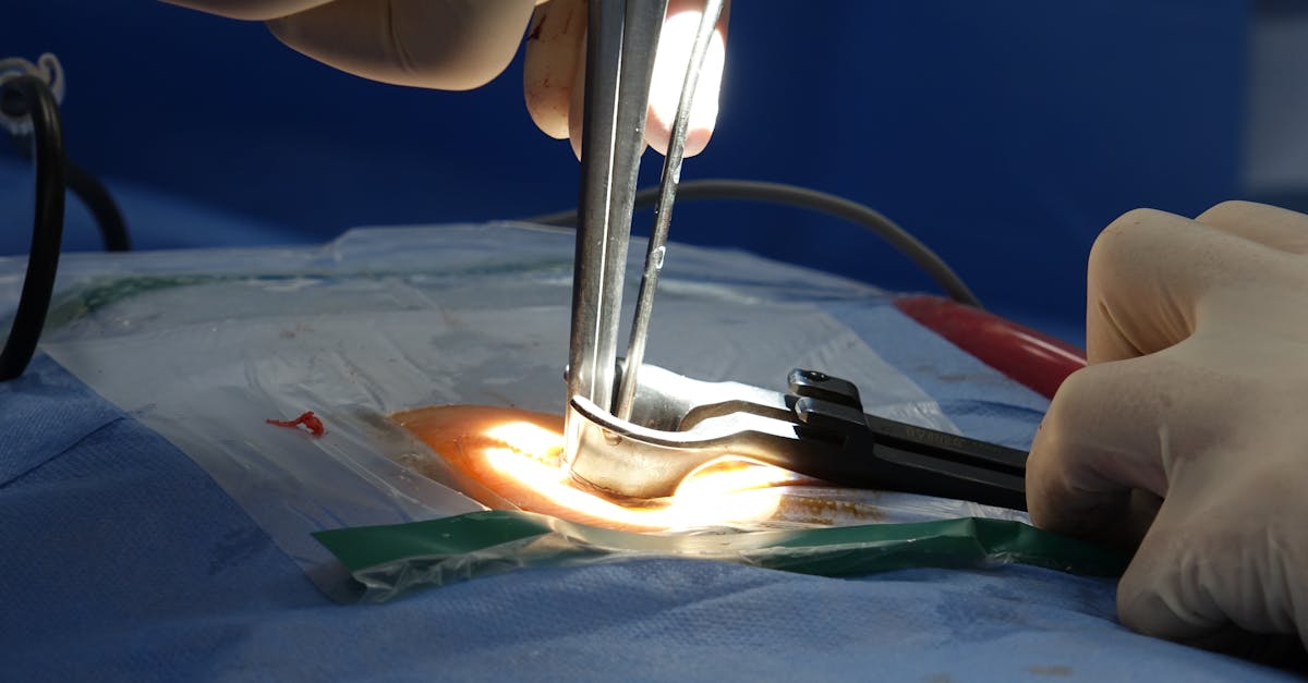 discover essential insights about herniated discs, their causes, symptoms, and effective treatment options. learn how to manage pain and improve your quality of life.