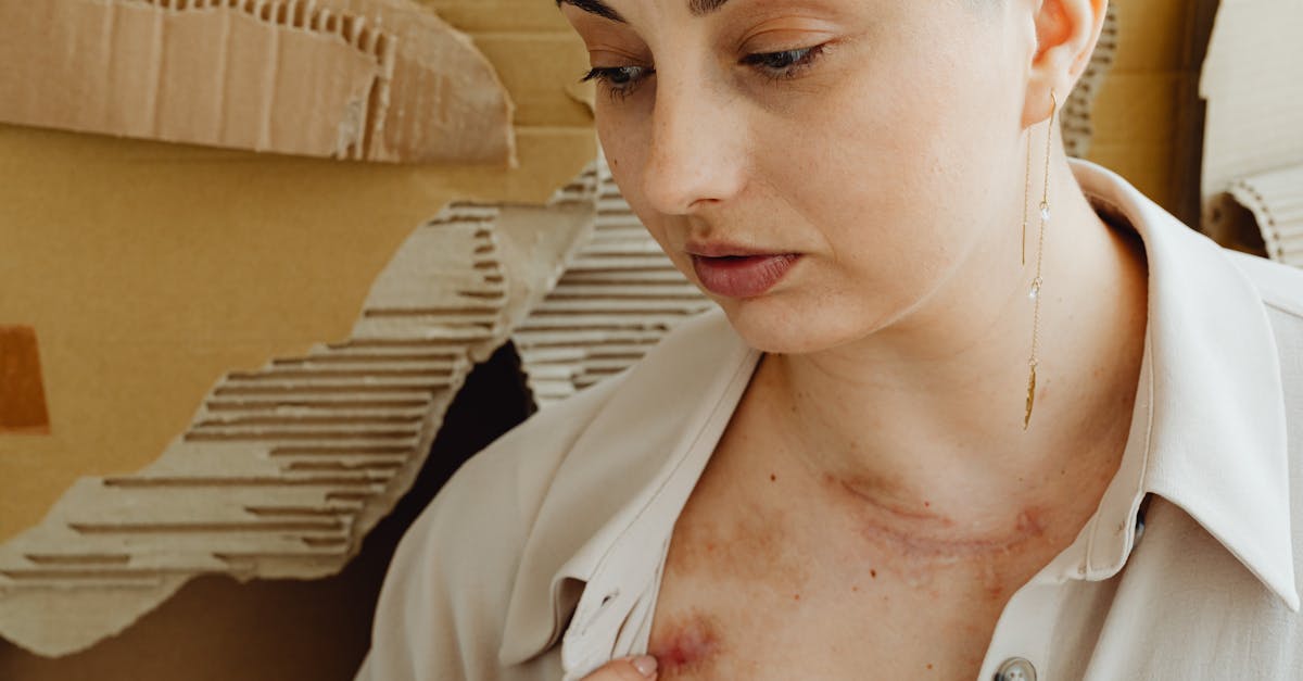 découvrez des solutions et des informations efficaces pour gérer la douleur à l’omoplate. découvrez les causes courantes, les symptômes et les traitements pour soulager l'inconfort et améliorer votre mobilité.