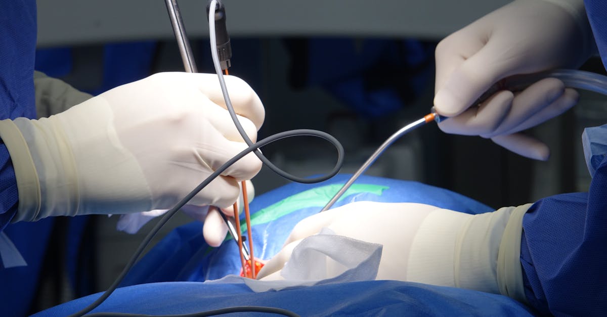 discover the causes, symptoms, and treatment options for spinal stenosis. learn how this condition can affect your mobility and overall health, and find effective strategies for managing pain and improving quality of life.
