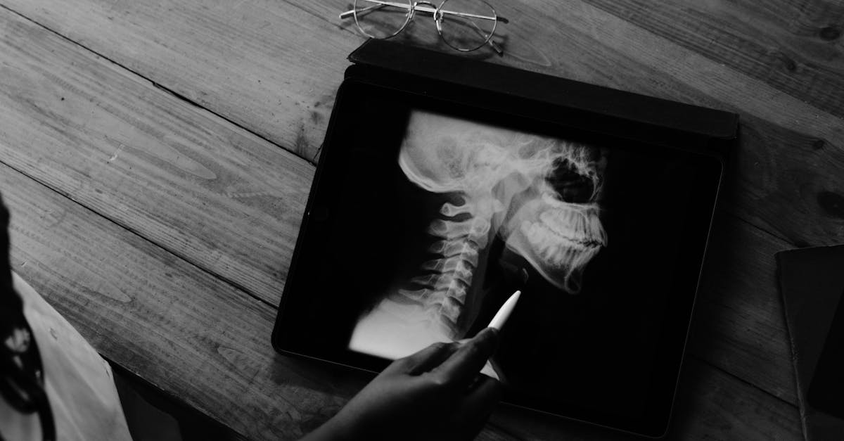 discover the causes and solutions for tech neck, a common condition resulting from prolonged device use. learn effective exercises, posture tips, and ergonomic solutions to relieve discomfort and prevent future issues.