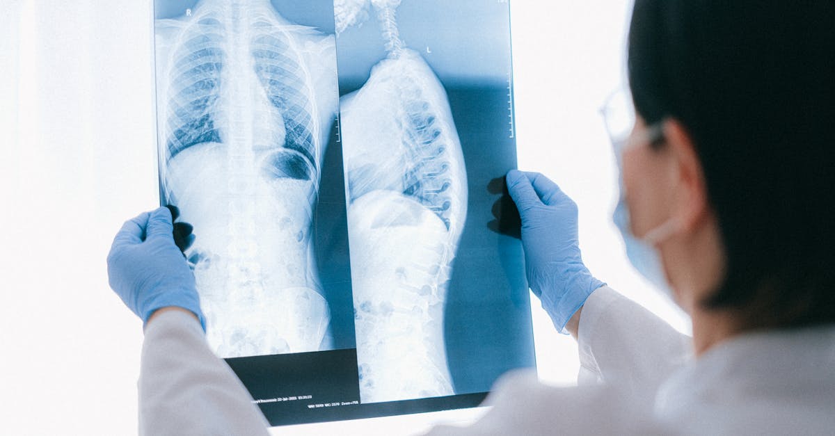discover effective strategies for understanding and managing thoracic spine pain. explore causes, symptoms, and treatment options to alleviate discomfort and improve your quality of life.