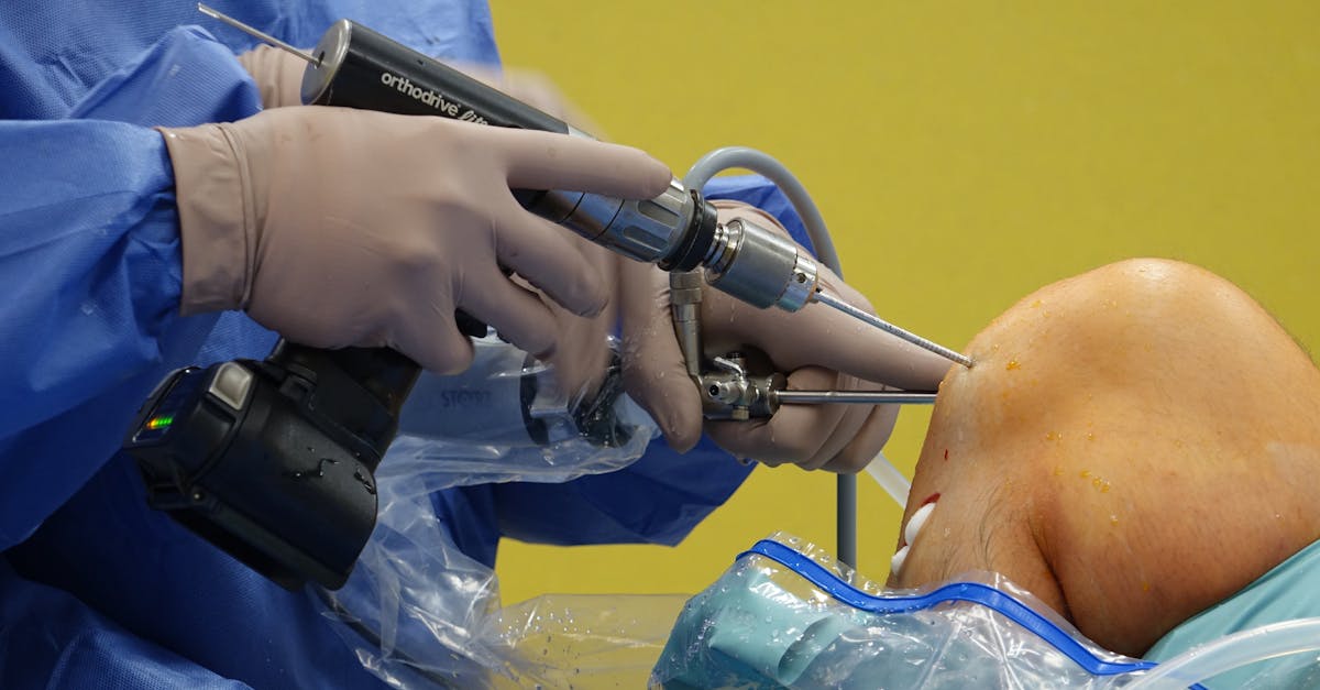 explore the causes, symptoms, and treatment options for brachial plexus injuries. learn about the impact on mobility and function, as well as the latest advancements in rehabilitation and recovery strategies.
