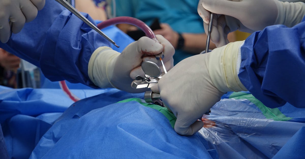 discover insights about herniated discs, including symptoms, causes, and treatment options. understand how this condition affects your spine and learn effective strategies for relief and recovery.
