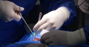 learn about herniated discs, including symptoms, causes, treatment options, and recovery strategies. explore effective ways to manage pain and improve mobility with expert insights.