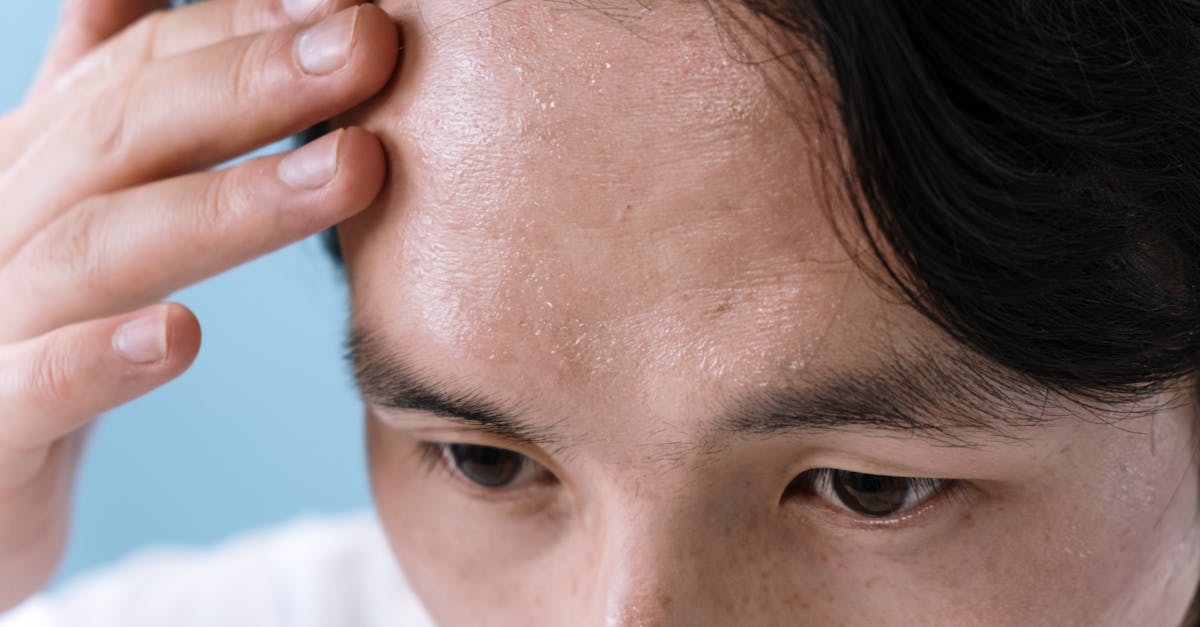discover effective relief strategies for tension headaches, from understanding their causes to practical solutions for pain management. learn how to identify triggers and improve your quality of life.